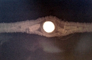X-ray